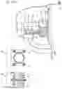 Fig. 87 - APPARATUS FOR CONTROLLING FLOW IN A BODILY ORGAN