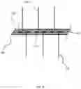 Fig. 06 - Embolization devices and methods of manufacturing the same