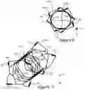 Fig. 06 - Aneurysm implant support device