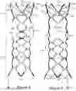Fig. 07 - Aneurysm implant support device