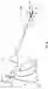 Fig. 02 - Devices and methods facilitating the manufacture of surgical instruments