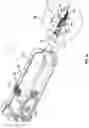 Fig. 02 - Drive mechanisms for surgical instruments