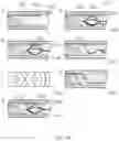 Fig. 35 - Apparatus for orientation display and alignment in percutaneous devices