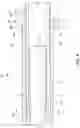Fig. 09 - Adjustable strut assemblies for external fixation systems