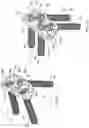 Fig. 22 - BONE DISPLACEMENT SYSTEM AND METHOD