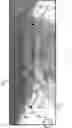 Fig. 01 - Systems And Methods For Forming Patient-Specific Spinal Rods