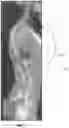 Fig. 08 - Systems And Methods For Forming Patient-Specific Spinal Rods