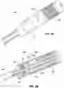 Fig. 04 - CARDIAC CATHETER WITH DEFORMABLE BODY