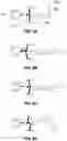 Fig. 06 - CARDIAC CATHETER WITH DEFORMABLE BODY