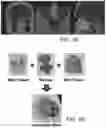 Fig. 06 - Mixed-reality endoscope and surgical tools with haptic feedback for integrated virtual-reality visual and haptic surgical simulation