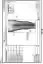 Fig. 04 - Software for use with deformity correction