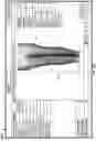 Fig. 06 - Software for use with deformity correction