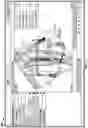Fig. 16 - Software for use with deformity correction