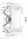Fig. 03 - Reference Navigation Equipment in Robotic Surgery Assisted by Stereotaxic Navigation of the Organs and Soft Parts of a Patient's Pelvic Area