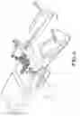 Fig. 05 - Reference Navigation Equipment in Robotic Surgery Assisted by Stereotaxic Navigation of the Organs and Soft Parts of a Patient's Pelvic Area