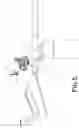 Fig. 06 - Reference Navigation Equipment in Robotic Surgery Assisted by Stereotaxic Navigation of the Organs and Soft Parts of a Patient's Pelvic Area