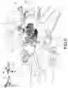 Fig. 07 - Reference Navigation Equipment in Robotic Surgery Assisted by Stereotaxic Navigation of the Organs and Soft Parts of a Patient's Pelvic Area