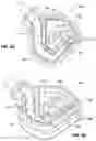 Fig. 04 - Hybrid approach to distortion detection