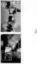 Fig. 07 - Interactive display for surgery with mother and daughter video feeds
