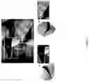Fig. 08 - Interactive display for surgery with mother and daughter video feeds