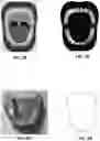 Fig. 06 - Tracking orthodontic treatment using teeth images