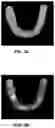 Fig. 07 - Tracking orthodontic treatment using teeth images