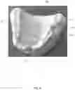 Fig. 04 - DENTAL IMPLANT