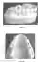 Fig. 07 - DENTAL IMPLANT