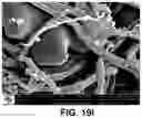 Fig. 22 - Device and method for treatment of an artificial bone implant with blood