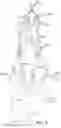 Fig. 04 - Systems and methods for transcatheter aortic valve treatment