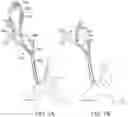 Fig. 05 - Systems and methods for transcatheter aortic valve treatment