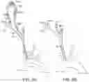 Fig. 06 - Systems and methods for transcatheter aortic valve treatment