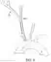 Fig. 07 - Systems and methods for transcatheter aortic valve treatment
