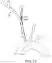 Fig. 08 - Systems and methods for transcatheter aortic valve treatment