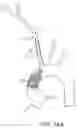 Fig. 19 - Systems and methods for transcatheter aortic valve treatment