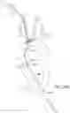 Fig. 23 - Systems and methods for transcatheter aortic valve treatment
