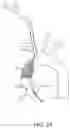 Fig. 27 - Systems and methods for transcatheter aortic valve treatment