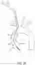 Fig. 28 - Systems and methods for transcatheter aortic valve treatment