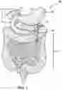 Fig. 02 - Devices, systems, and methods for pyloric occlusion