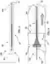 Fig. 06 - Devices, systems, and methods for pyloric occlusion