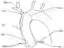 Fig. 01 - ASCENDING AORTIC STENT GRAFT