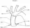 Fig. 07 - ASCENDING AORTIC STENT GRAFT