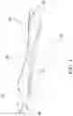 Fig. 02 - Silicone Prosthesis Delivery Apparatus and Methods of Use