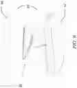 Fig. 09 - Silicone Prosthesis Delivery Apparatus and Methods of Use