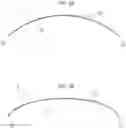 Fig. 04 - Corneal implant