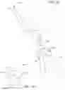 Fig. 22 - Delivery and retrieval devices and methods for side-deliverable transcatheter prosthetic valves