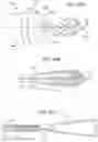 Fig. 34 - Delivery and retrieval devices and methods for side-deliverable transcatheter prosthetic valves