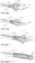 Fig. 40 - Delivery and retrieval devices and methods for side-deliverable transcatheter prosthetic valves