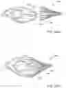 Fig. 48 - Delivery and retrieval devices and methods for side-deliverable transcatheter prosthetic valves