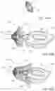 Fig. 49 - Delivery and retrieval devices and methods for side-deliverable transcatheter prosthetic valves